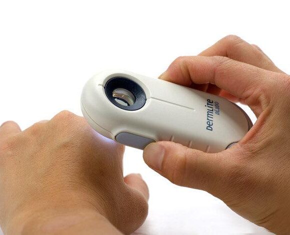 dermlite-dl100-dermlite-1_5000x (1)